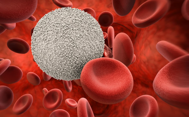 Dose Reduction of Selinexor Combo Demonstrates Efficacy in Multiple Myeloma – Cancer Network